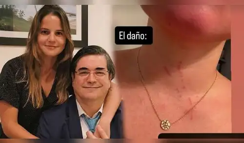 Silvia Núñez del Arco compartió que le rasguñaron el cuello. elpopular.pe