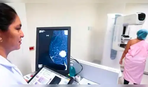 ¡SIN SEGURO Y SIN CITA! Minsa activa despistaje GRATUITO de cáncer en todo el Perú: revisa cómo acceder elpopular.pe