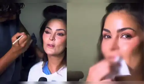 Laura Spoya expone las secuelas del choque que sufrió y explica por qué su diente sigue fracturado. elpopular.pe