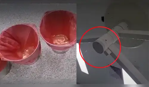 Médicos operan a paciente mientras cae agua del techo en Hospital de San Juan de Lurigancho. elpopular.pe