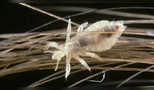 ¡Alerta en los colegios! Minsa advierte aumento de contagios de piojos y liendres. elpopular.pe