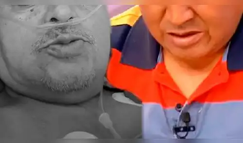 Cómico preocupa a fans con su salud. elpopular.pe