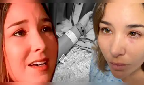 Ale Fuller aparece en clínica y revela el preocupante motivo elpopular.pe
