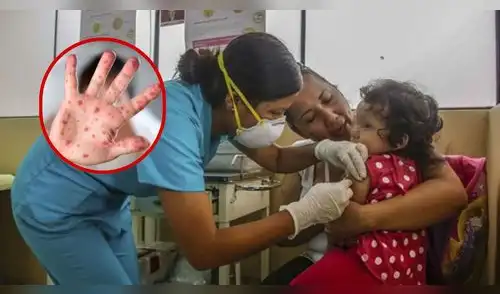 Minsa amplía por 90 días la emergencia sanitaria por el brote de sarampión. elpopular.pe