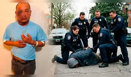 Hombre sufre lesión cerebral y hematomas luego de ser arrestado por el ICE. elpopular.pe