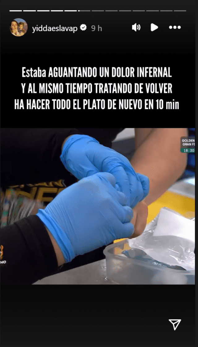 Yiddá Eslava explota EN VIVO con conocida actriz tras perder un pedazo de dedo Yiddá Eslava explota EN VIVO con conocida actriz tras perder un pedazo de dedo