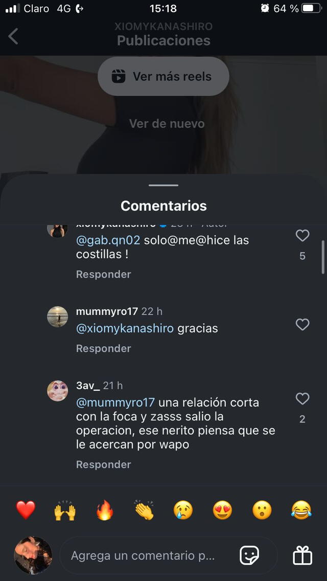 Xiomy Kanashiro responde si Jefferson Farfán costeó sus operaciones Xiomy Kanashiro responde si Jefferson Farfán costeó sus operaciones