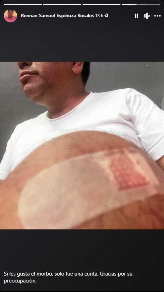 Rennan Espinoza minimiza aparatoso accidente que sufrió en el Día del Trabajador.