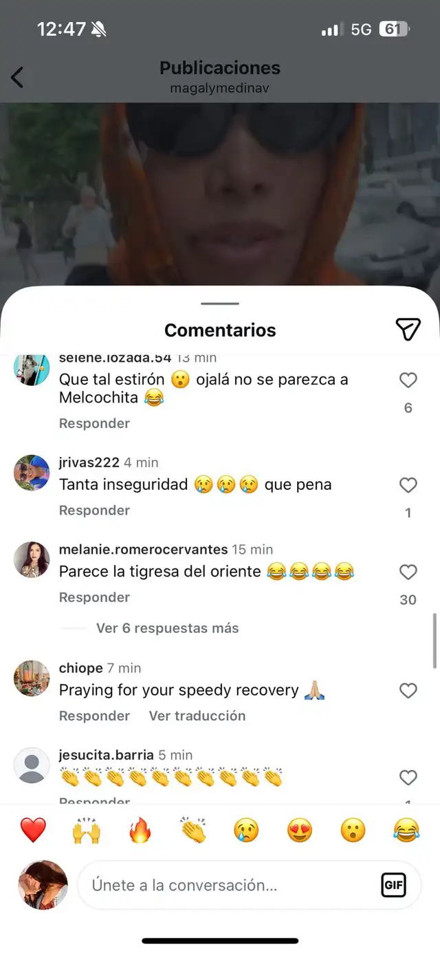  Magaly Medina sale del quirófano y luce irreconocible con su nuevo rostro 