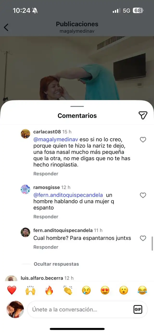  Magaly Medina revela el número exacto de cirugías en su rostro tras recientes 'retoquito' y la rechazan 