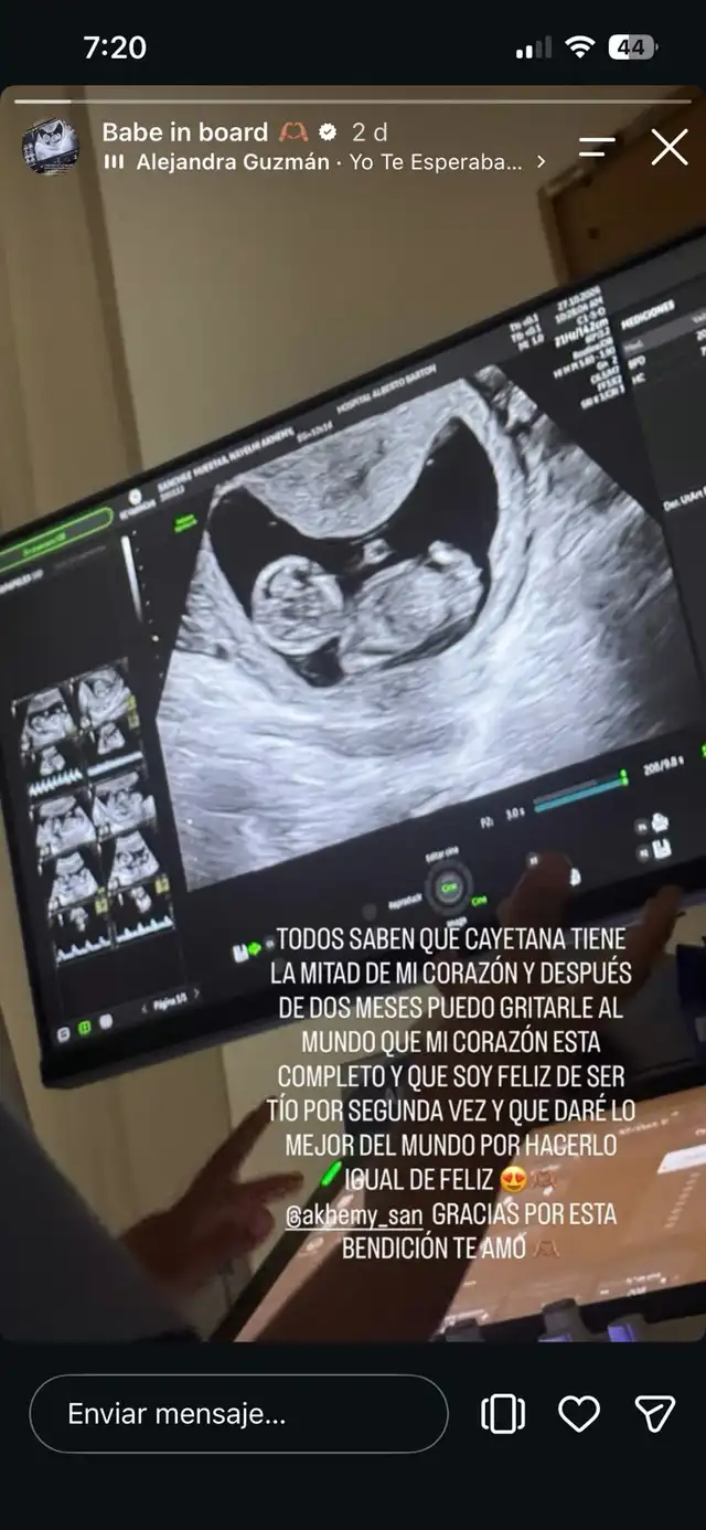Hermano de Jesús Barco anuncia que será tío por segunda vez y despierta rumores de embarazo de Melissa Klug Hermano de Jesús Barco anuncia que será tío por segunda vez y despierta rumores de embarazo de Melissa Klug