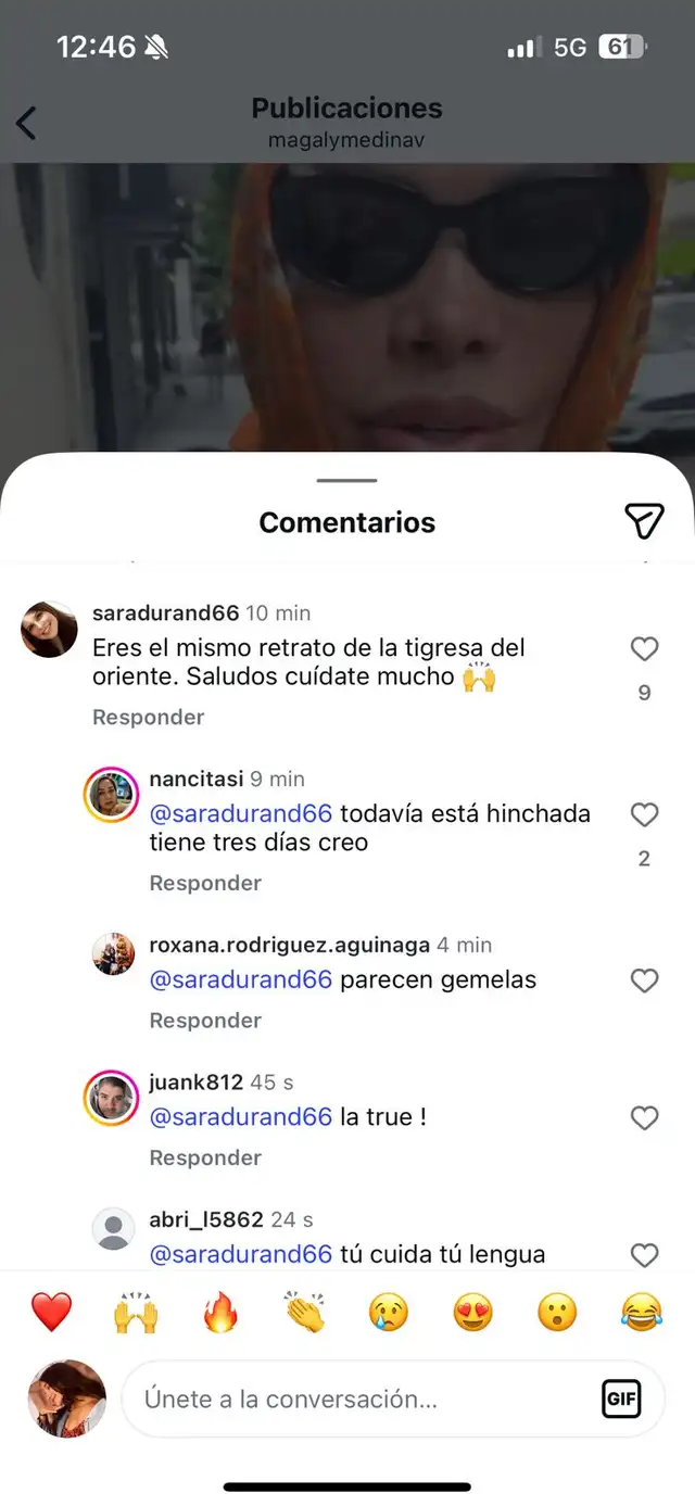  Magaly Medina sale del quirófano y luce irreconocible con su nuevo rostro 