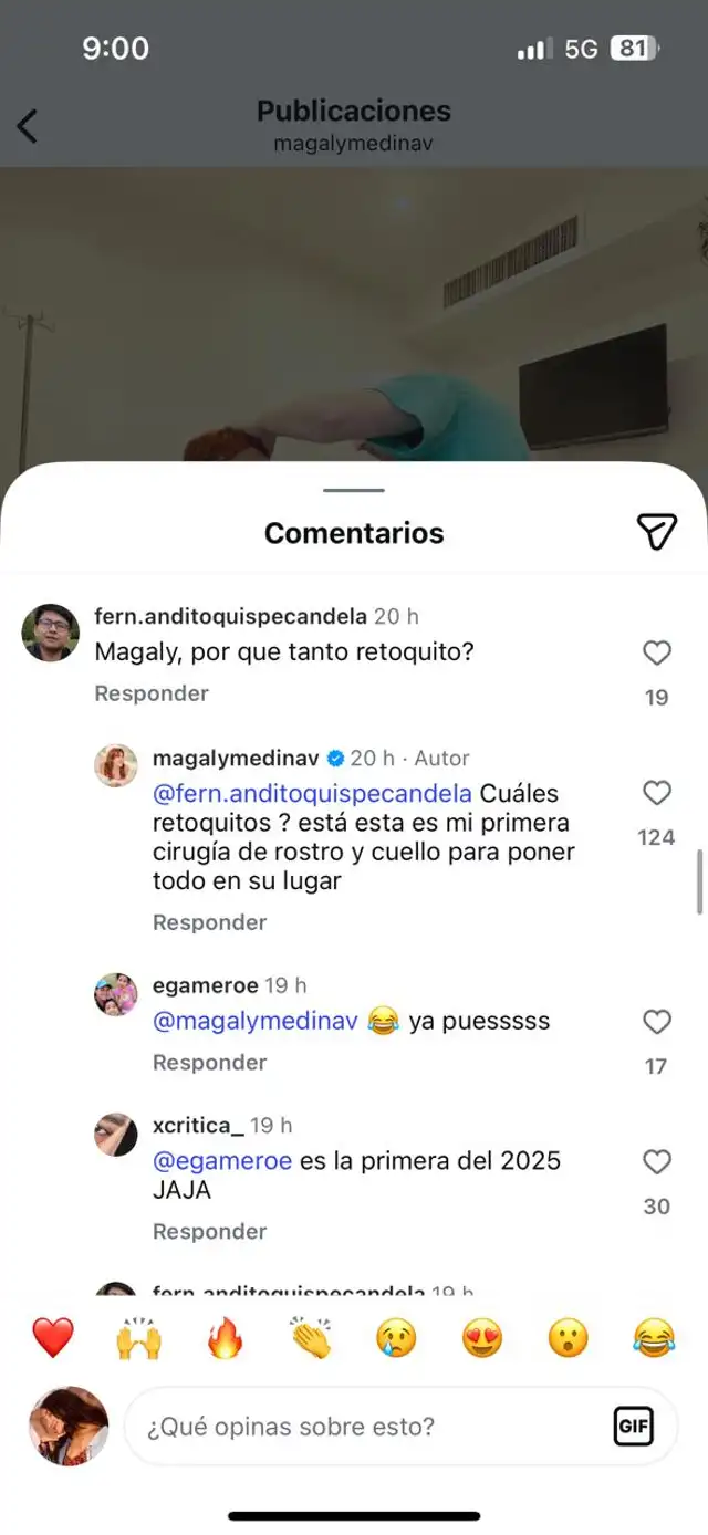 Magaly Medina revela el número exacto de cirugías en su rostro tras recientes 'retoquito' y la rechazan 