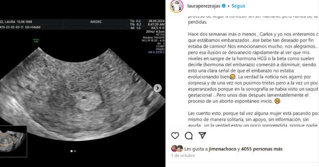 Actor Carlos de la Mota y su esposa perdieron a su bebé.  