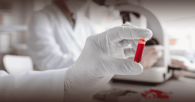 Las heces y la colonoscopia pueden detectar cáncer en el colon. Las heces y la colonoscopia pueden detectar cáncer en el colon.