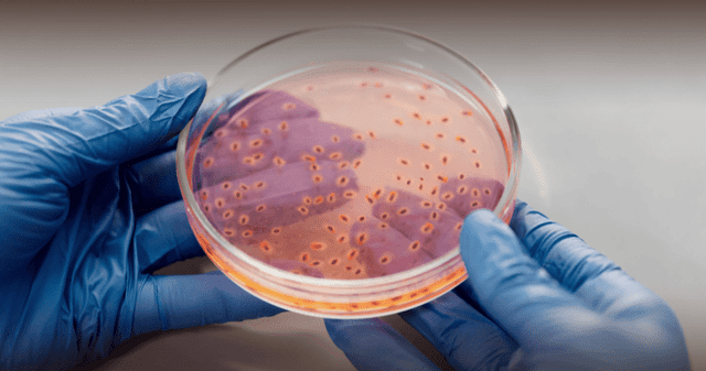 Bacterias y gérmenes: el enemigo oculto en las botellas de plástico. Bacterias y gérmenes: el enemigo oculto en las botellas de plástico.