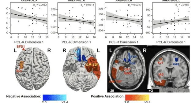 Representaciones de los escáneres cerebrales. Representaciones de los escáneres cerebrales.