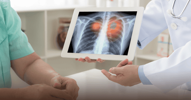 ¿El aire contaminado puede generar cáncer pulmonar?