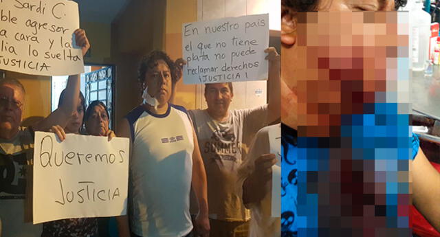 Desfiguran a padre de familia