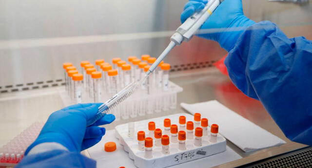 Primera prueba molecular peruana para detectar a la COVID-19 ya empezó a comercializarse El Popular