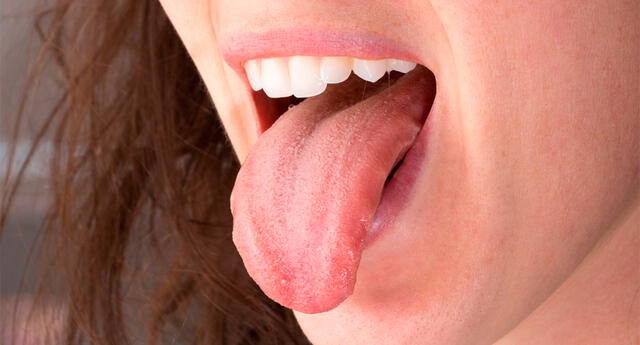 ¿Qué revela tu boca sobre tu salud? El Popular