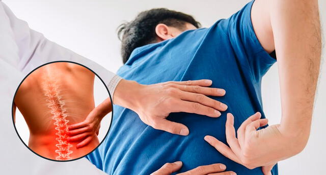 Cómo aliviar el golpe de aire en la espalda con remedios caseros | El  Popular