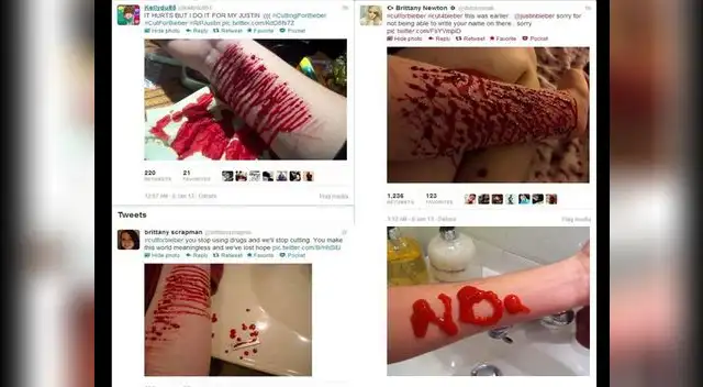 Cientos de jovencitas publican polémicas fotos con cortes por Justin Bieber.