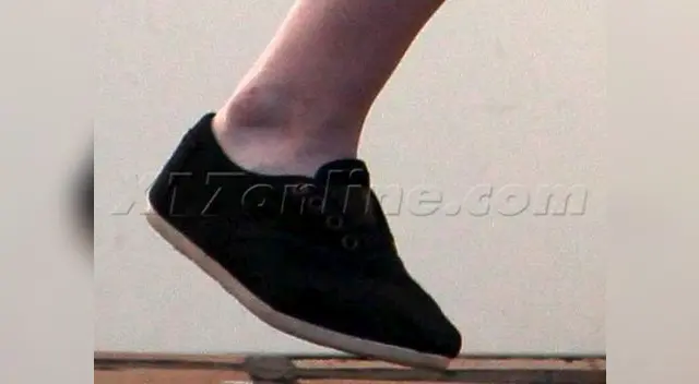 Pie hinchado de Kristen Stewart 