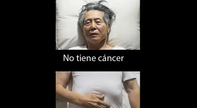 No hay enfermedad de cáncer en él.