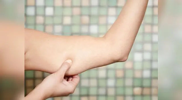 Los brazos es una de las partes del cuerpo más delicadas Los brazos es una de las partes del cuerpo más delicadas