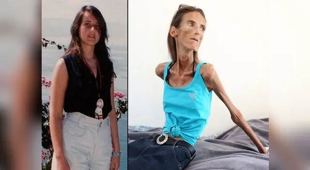 Valeria Levitina pesa tan solo 25 kilos.