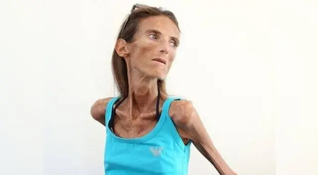 Valeria Levitina pesa tan solo 25 kilos.