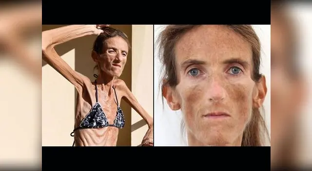 Valeria Levitina pesa tan solo 25 kilos.