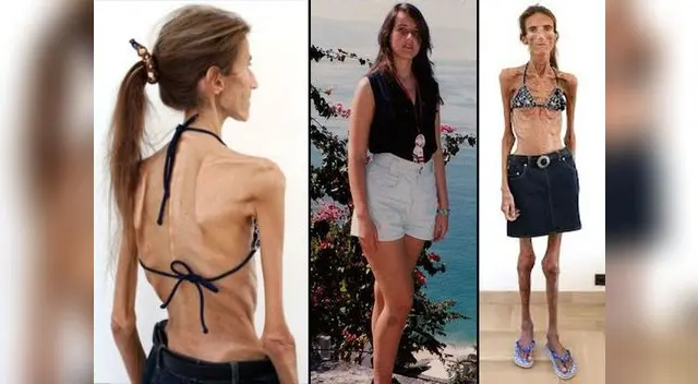 Valeria Levitina pesa tan solo 25 kilos.