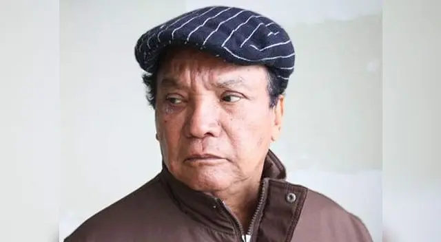 Melcochita tuvo accidente mientras grabada para El Cártel del Humor. Melcochita tuvo accidente mientras grabada para El Cártel del Humor.