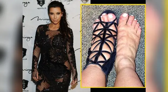 Kim Kardashiam compartió foto de sus pies hinchados en Instagram Kim Kardashiam compartió foto de sus pies hinchados en Instagram