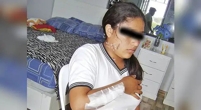 Así quedó la menor agredida.