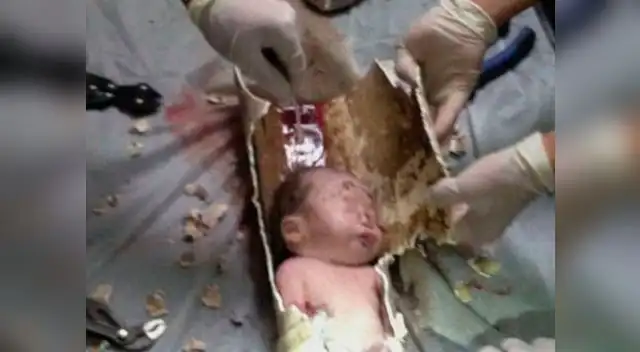 Bebé es rescatado luego de estar atrapado en tubería, en China. Bebé es rescatado luego de estar atrapado en tubería, en China.