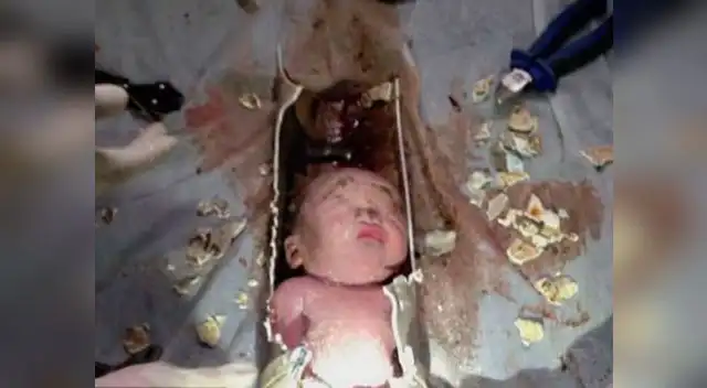 Bebé es rescatado luego de estar atrapado en tubería, en China. Bebé es rescatado luego de estar atrapado en tubería, en China.