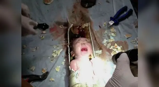 Bebé es rescatado luego de estar atrapado en tubería, en China. Bebé es rescatado luego de estar atrapado en tubería, en China.