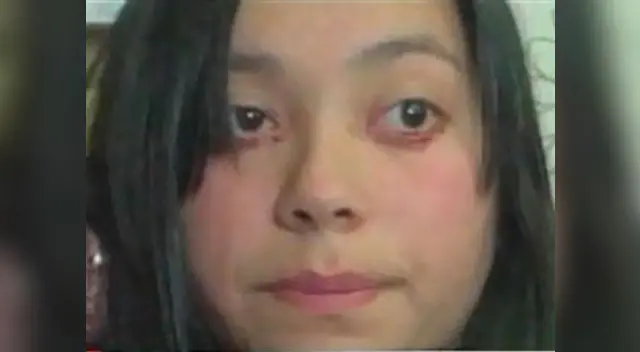 Chica padece de extraño mal que la hace llorar sangre. Chica padece de extraño mal que la hace llorar sangre.