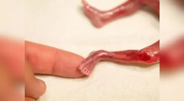 Walter Joshua Fretz pudo estar en brazos de sus padres y hermanas. Walter Joshua Fretz pudo estar en brazos de sus padres y hermanas.