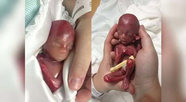 Walter Joshua Fretz pudo estar en brazos de sus padres y hermanas. Walter Joshua Fretz pudo estar en brazos de sus padres y hermanas.