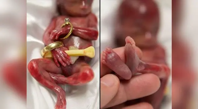 Walter Joshua Fretz pudo estar en brazos de sus padres y hermanas. Walter Joshua Fretz pudo estar en brazos de sus padres y hermanas.