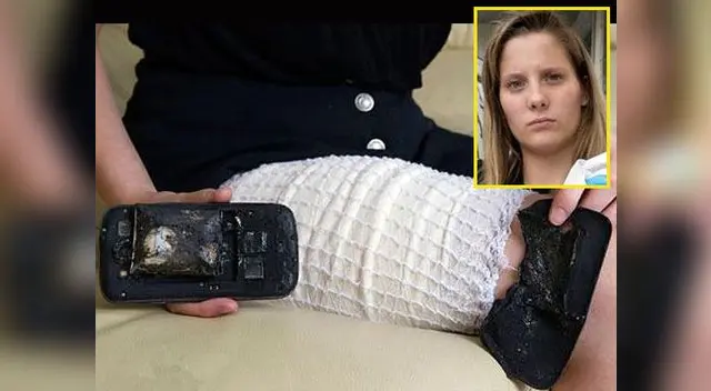 Galaxy S3 explota en pierna de joven y le causa quemaduras de tercer grado Galaxy S3 explota en pierna de joven y le causa quemaduras de tercer grado