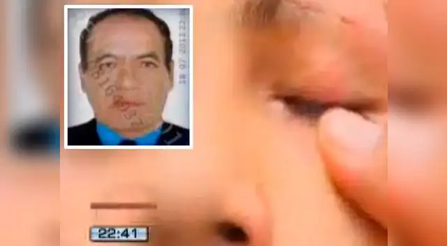 Profesor golpea a alumno y le causa lesiones en el ojo.