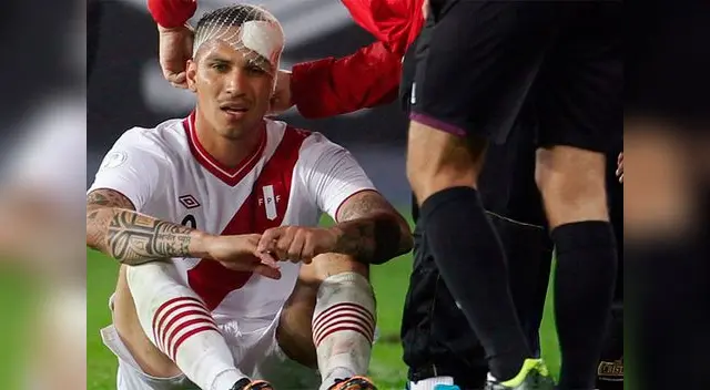 Paolo Guerero herido tras rotura de ceja. Árbitro no sacó amarilla a jugador charrúa que provocó falta.