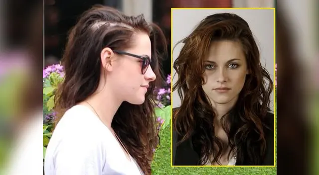Kristen Stewart sufre un severo problema de caída de cabello