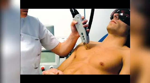 Son varios los beneficios de la depilación láser. Son varios los beneficios de la depilación láser.