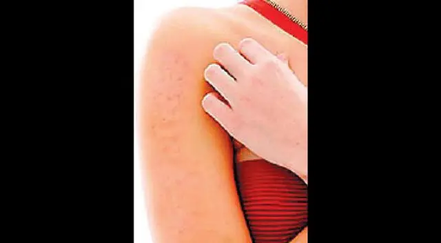 Más información sobre los ácaros en el medio ambiente. Más información sobre los ácaros en el medio ambiente.